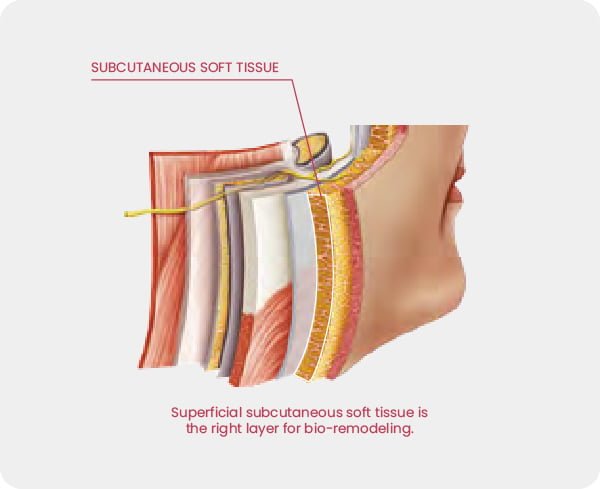 Showing the subcutaneous layer which is perfect for bio-remodeling