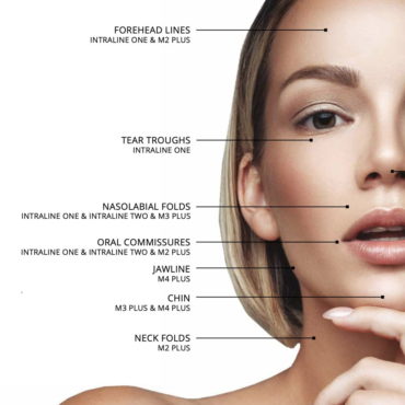 Intraline Dermal Filler application recommendations