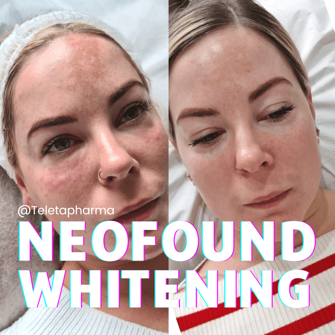 Neofound Whitening blog post